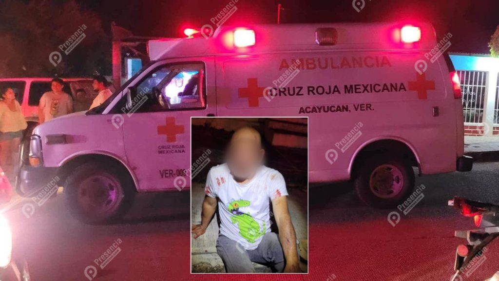 Golpean A Vecino Del Centro De La Ciudad De Acayucan Presencia Noticias